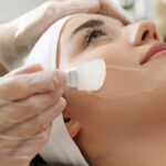 Are Chemical Peels Good for Your Face?