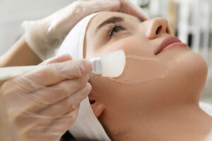 Are Chemical Peels Good for Your Face?