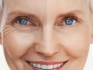 Are Chemical Peels Safe for Older Skin?