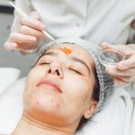 Are Monthly Chemical Peels Good?