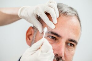 Can Age Spots Appear Overnight?