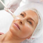 Can I Wear Makeup After a Chemical Peel?