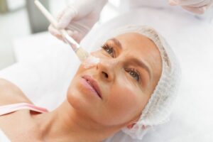 Can I Wear Makeup After a Chemical Peel?