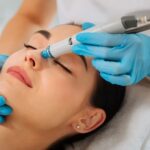Can You Overdo Microneedling?