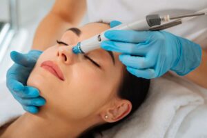 Can You Overdo Microneedling?