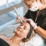 Can You See Results from Microneedling After One Session?