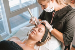 Can You See Results from Microneedling After One Session?