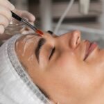 Do Dermatologists Recommend Chemical Peels?