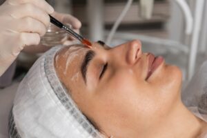 Do Dermatologists Recommend Chemical Peels?