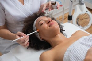 Does a Chemical Peel Hurt?