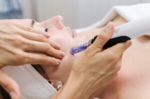 Does Microneedling Really Make a Difference?
