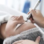 Does Microneedling Really Work for Wrinkles?