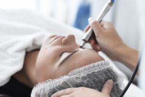 Does Microneedling Really Work for Wrinkles?