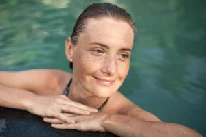 Does Vitamin C Help with Sun Spots?