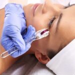 Does Your Face Peel After Microneedling?