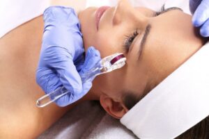 Does Your Face Peel After Microneedling?