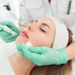 How Do You Maximize Microneedling Results?