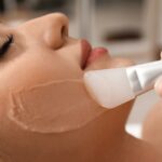 How Do You Sleep With a Chemical Peel?