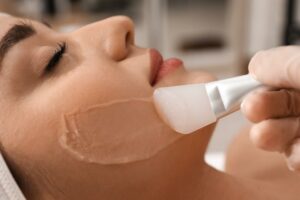 How Do You Sleep With a Chemical Peel?