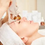 How Do You Take Care of Your Face After a Chemical Peel?