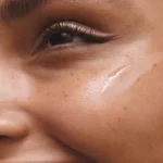 How Do You Treat Dark Spots on Your Face?