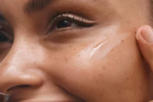 How Do You Treat Dark Spots on Your Face?