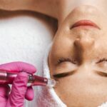 How Long Does it Take for Collagen to Rebuild After Microneedling?