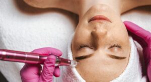 How Long Does it Take for Collagen to Rebuild After Microneedling?