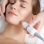 How Long Does Microneedling Last?