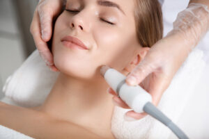 How Long Does Microneedling Last?