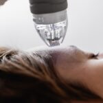 How Long Does Skin Purge After Microneedling?