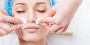 How Many Chemical Peels Until You See Results?