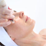 How Many Microneedling Sessions Do You Need?