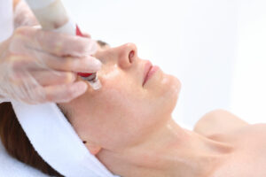 How Many Microneedling Sessions Do You Need?