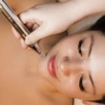 How Many Sessions of Microneedling Do You Need?
