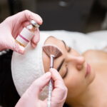 Can Chemical Peels Remove Scars?