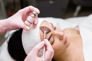 Can Chemical Peels Remove Scars?