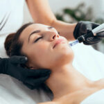 How Often Should You Microneedle?