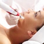 How Painful is Microneedling?