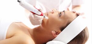 How Painful is Microneedling?