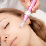 How Soon Can I Shower After Microneedling?