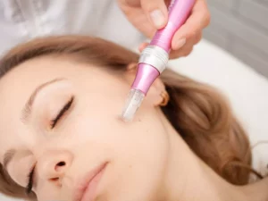 How Soon Can I Shower After Microneedling?