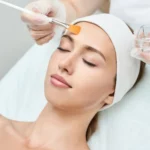 How Soon Should I Moisturize After a Chemical Peel?
