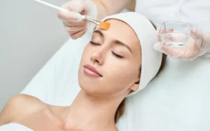 How Soon Should I Moisturize After a Chemical Peel?