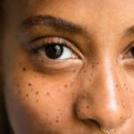 How to Lighten Dark Spots Overnight?