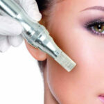 How to Speed Up Healing After Microneedling?