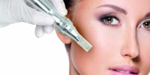 How to Speed Up Healing After Microneedling?