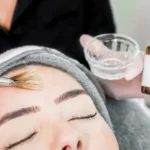 Is a Chemical Peel Good for Your Skin?