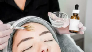 Is a Chemical Peel Good for Your Skin?