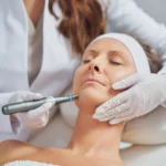 Is Microneedling Good for Your Face?